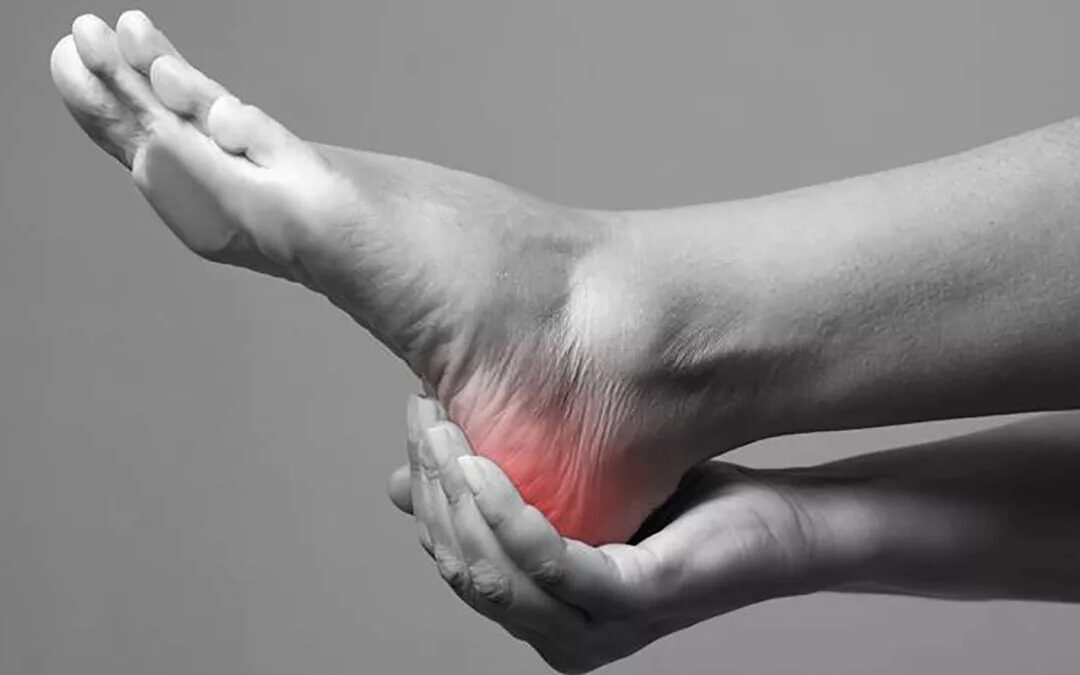 ¿Qué es y cómo puede tratarse la fascitis plantar?