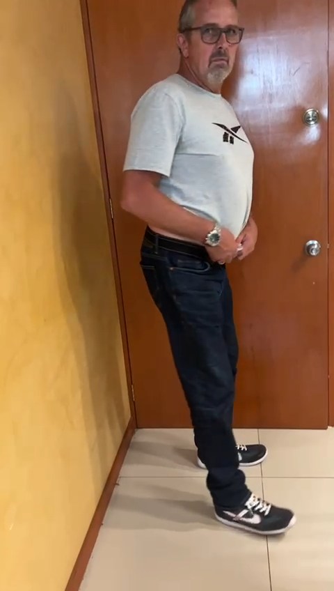 Paciente con cuadro de Lumbociática Severa con Meralgia parestésica